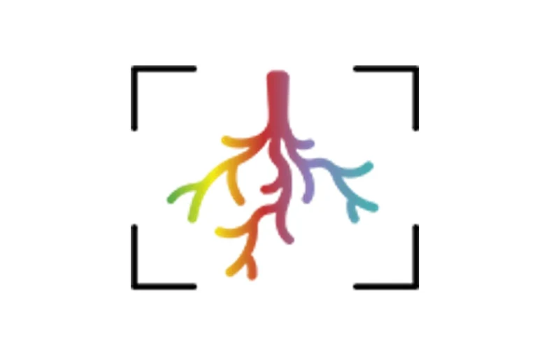 Rhizosphere Spatiotemporal Organisation