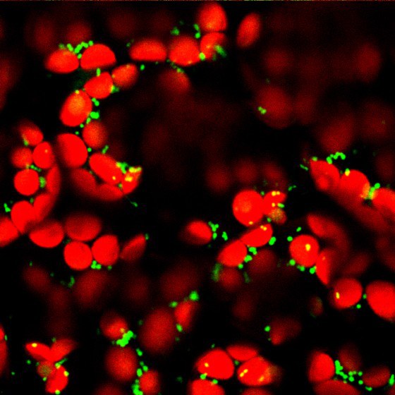 Mikroskopische Aufnahme der Mitochondrien (grün) und der Chloroplasten (rot) in Mesophyllzellen in einem Blatt der Ackerschmalwand (Arabidopsis thaliana). Der Innenraum der Mitochondrien (Matrix) ist durch ein fluoreszierendes Protein markiert; in den Chloroplasten fluoresziert das Chlorophyll.