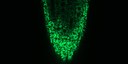 Mikroskopische Aufnahme der Mitochondrien in einer Wurzelspitze der Ackerschmalwand (Arabidopsis thaliana).
